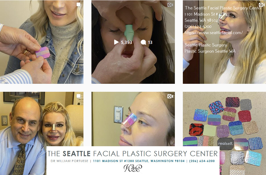 seattle nose job